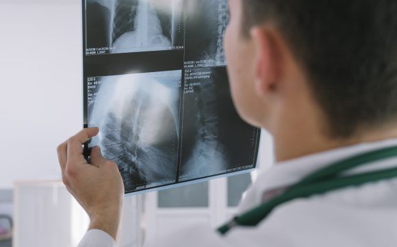 Traumatologia y Cirugía Ortopedica